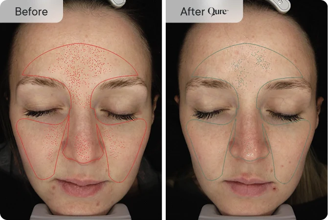 Large Pores & Skin Texture