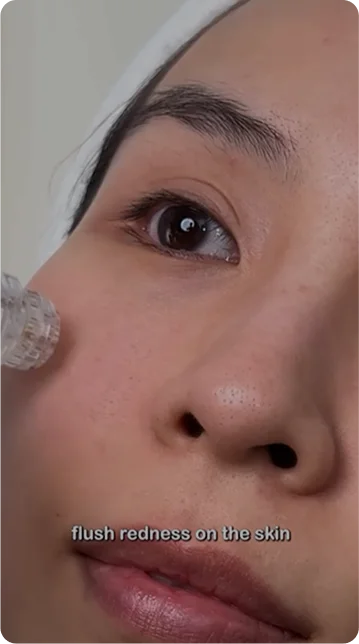 Confident skin starts here