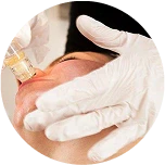 Derma Roller At-Home Treatment