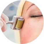 Qure Micro-Infusion System