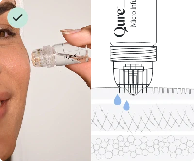 Qure Micro-Infusion System