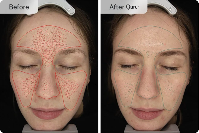 Dark Spots
